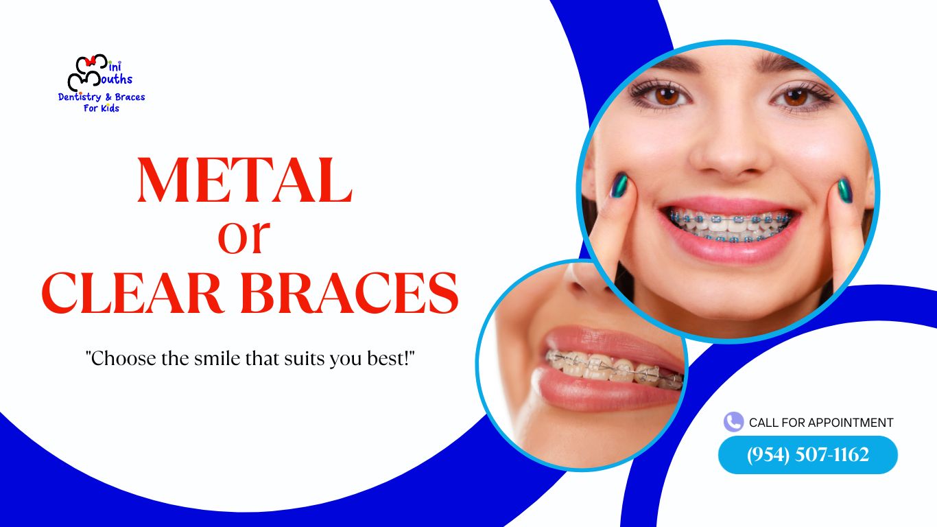 Metal or Clear Braces Orthodontics Coral Springs